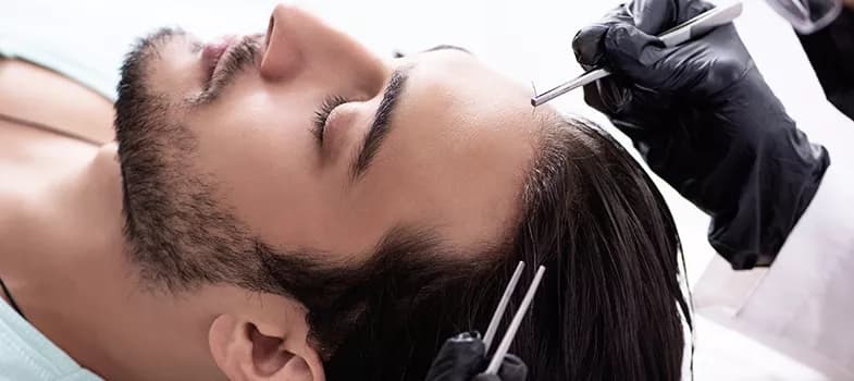 Haartransplantation istanbul: Der Weg zu vollerem Haar
