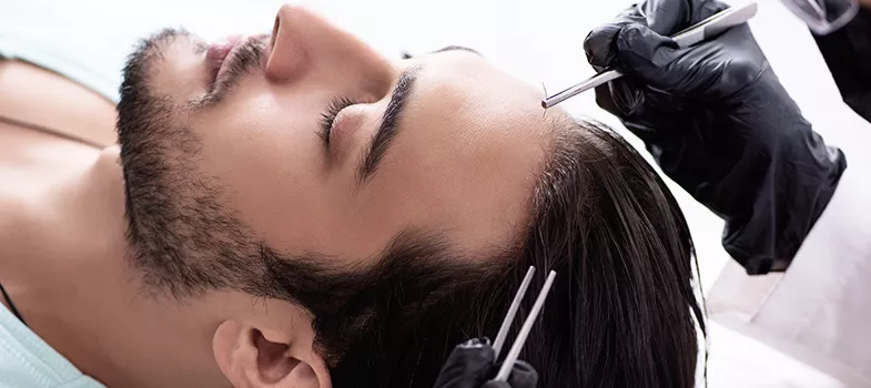 Haartransplantation istanbul: Der Weg zu vollerem Haar